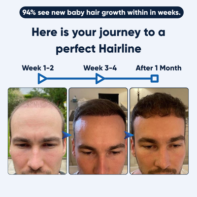 Hairline Regrowth Serum