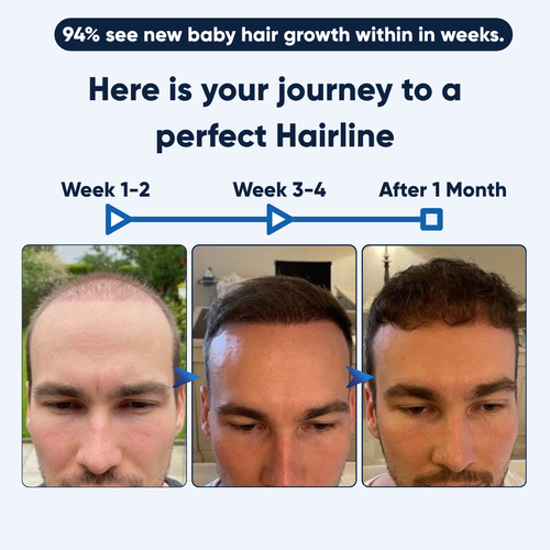 Hairline Regrowth Serum