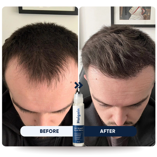 Last Price: Buy 1, Get 1 Free