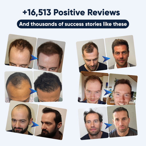 Hairline Regrowth Serum