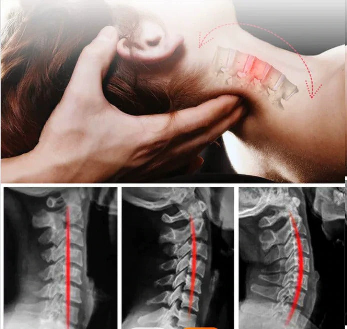 Neck Stretcher